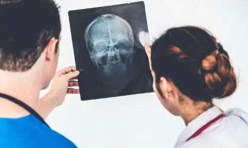 A doctor holding up an X-Ray image of a patient's head for them to see.