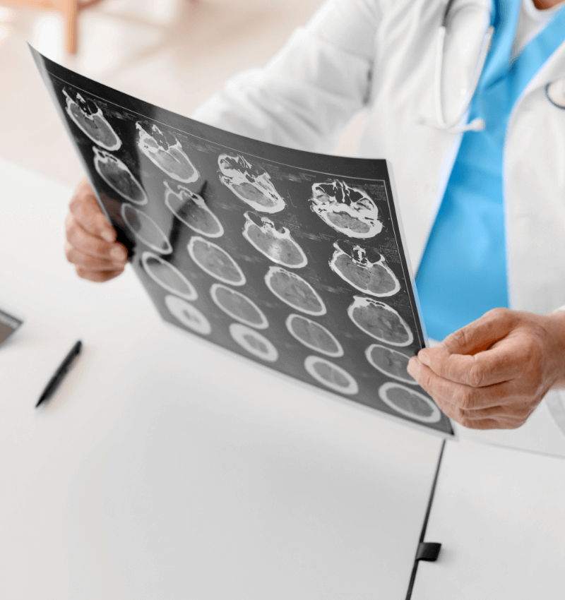 Hillstone Law Brain Injuries Lawyer