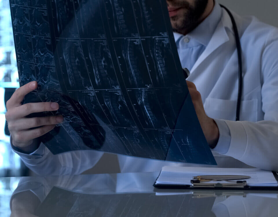 Spinal Cord Injury Lawyer in California: Your Rights After a Life-Altering Accident
