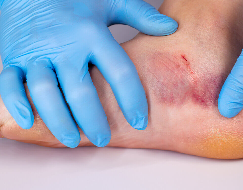 Dog Bite Injury Lawyer in California: Protecting Victims of Animal Attacks