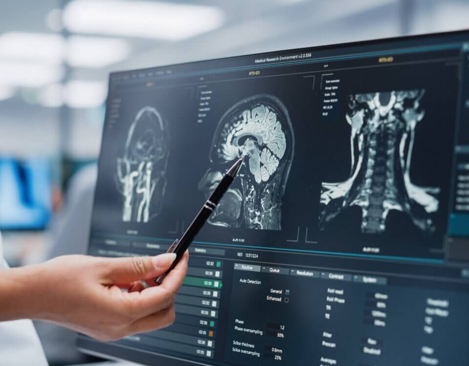 Football-Related Brain Injuries in California: What You Need to Know