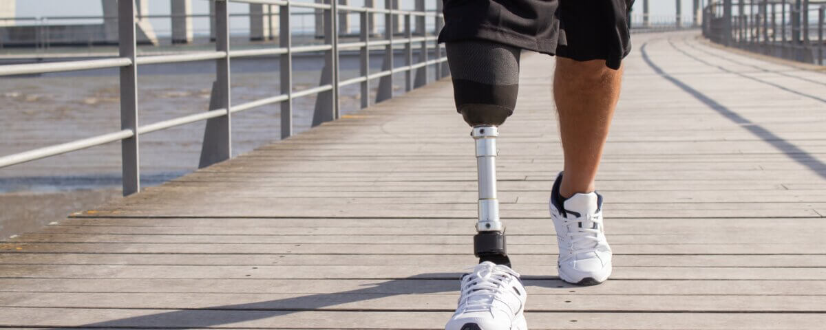 Amputation Injury Lawyer in California: Fighting for Victims of Catastrophic Injuries