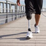 Amputation Injury Lawyer in California: Fighting for Victims of Catastrophic Injuries
