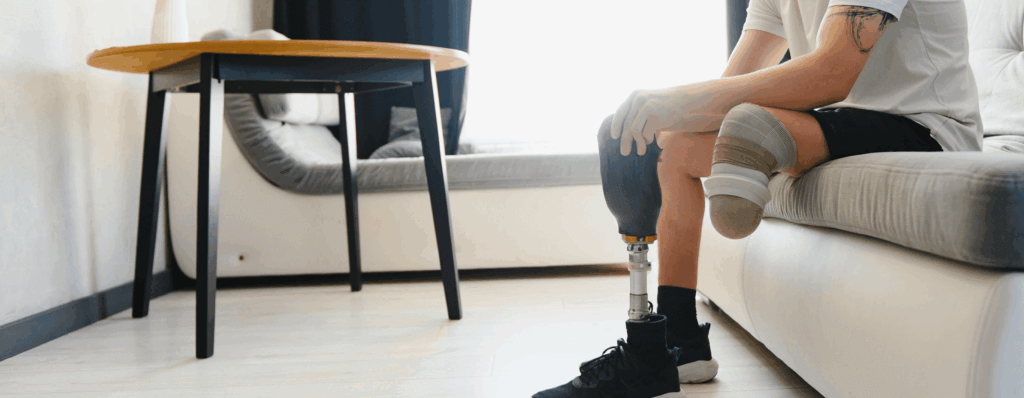 Amputation Injury Lawyers