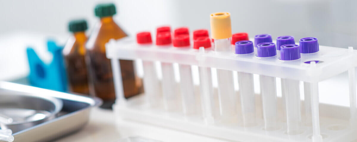Essential Guide to California’s New Alcohol Testing Kit Law