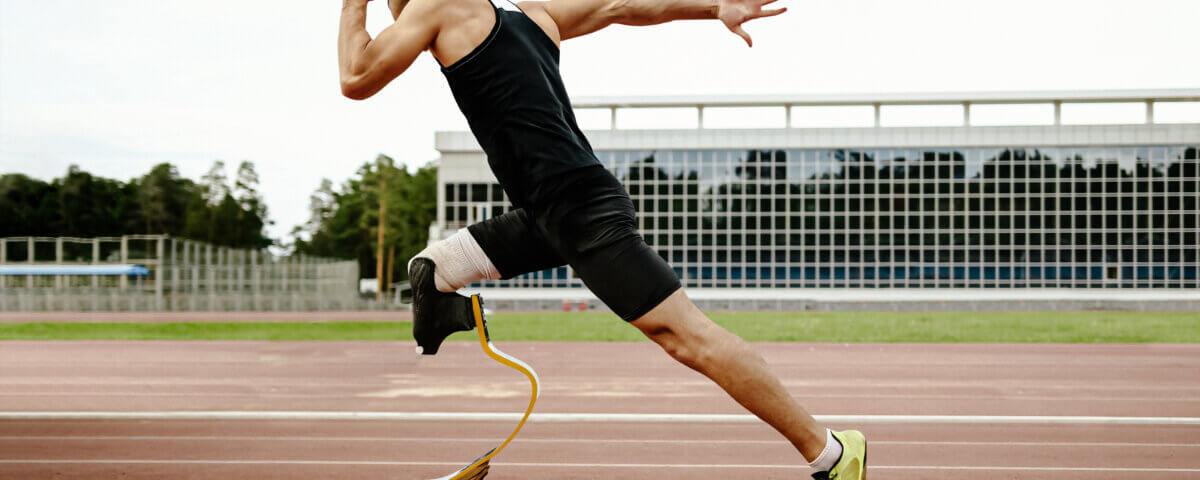 Overcoming the Challenges of Limb Loss