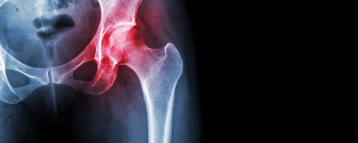 /fr/a-step-by-step-guide-to-getting-your-motorcycle-permit-in-california/